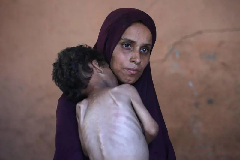 Gaza, l’orrore della "fame di massa"
