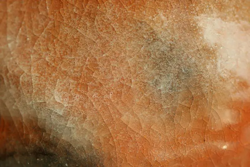 Come proteggersi dal melanoma, uno dei tumori maligni più diffusi