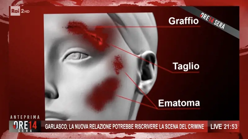 Screen Ore 14 Sera