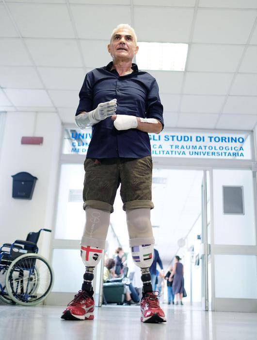 Zanda con le protesi 