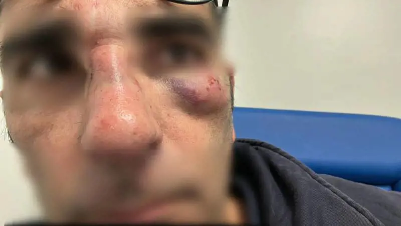 Non ha il biglietto e massacra di botte un esponente di FdI: fermato uno straniero
