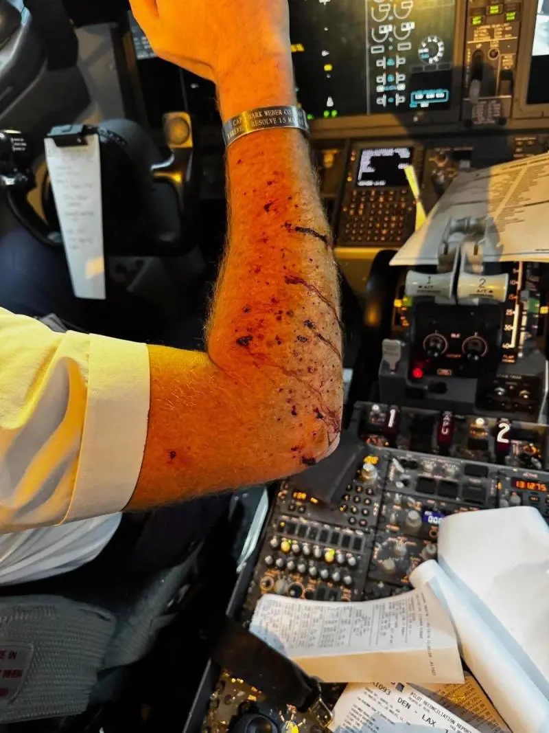 Paura a 11 mila metri di altezza, aereo colpito da un possibile "detrito spaziale": ferito il pilota