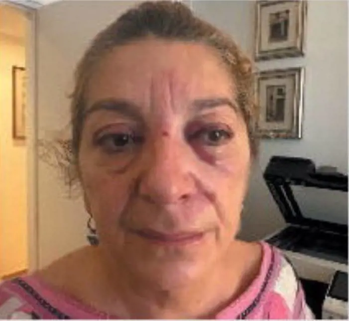 Aggredita in strada. Criticava la Salis