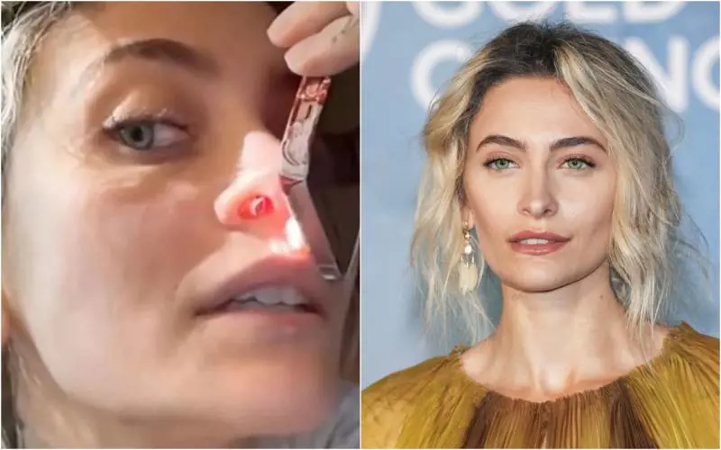 "Setto nasale perforato dalla droga". Il video choc di Paris Jackson 