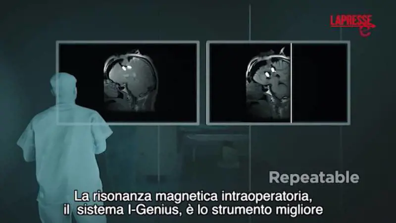 Esaote: entra nel campo della neurochirurgia e presenta il sistema di risonanza magnetica intraoperatoria I-Genius