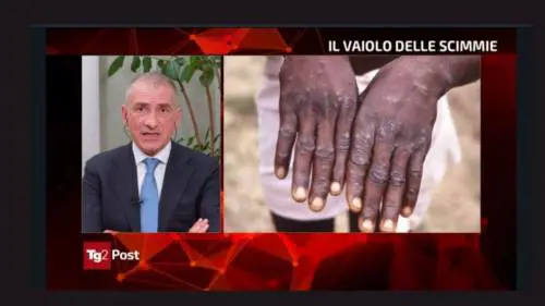 Vaiolo, “niente caccia all’untore”. Ma con i no vax si poteva fare