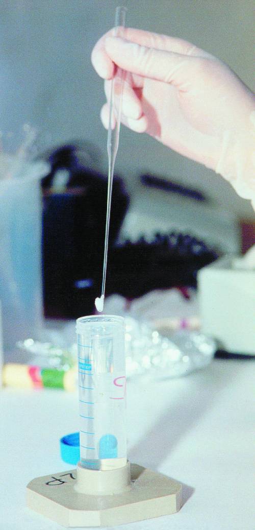 Biotech, così si uccide la ricerca