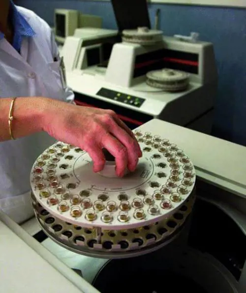 Fatta la coda, Burlando taglia le liste dattesa