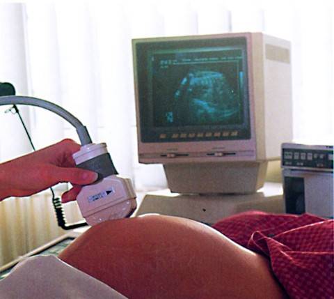 Offerta choc, aborto 
in regalo per Natale