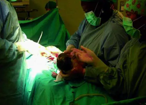 Medici in Africa, quel «taglio cesareo» del primo dellanno, là nel Madagascar