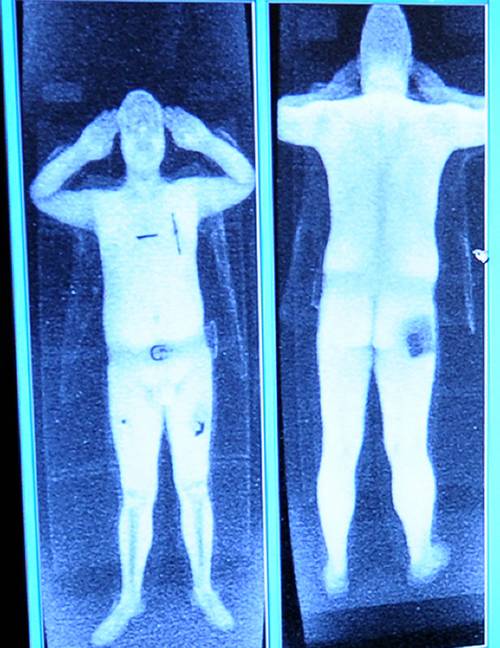 Body scanner, Fazio: "Attenzione alla salute"
