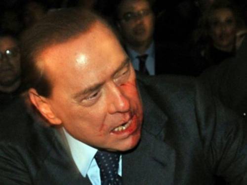 Ultimo dispetto: Silvio processato pure in clinica