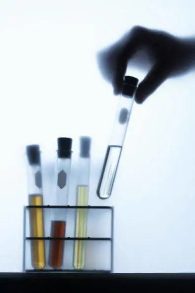 Cancro alla prostata, al via oggi la maratona scientifica