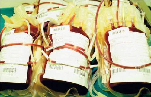Donatori di sangue,  
ipotesi prelievo 
anche ai minorenni