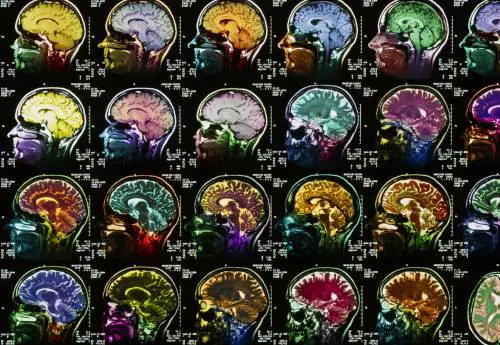 Ma il «minimo di coscienza» non si misura