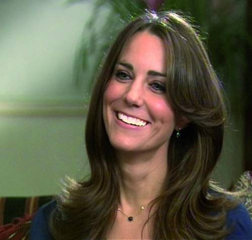 Il segreto del sorriso di Kate Middleton