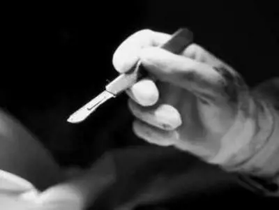 Associazione Urologi Italiani, progressiva riduzione dell’uso del bisturi in uro oncologia