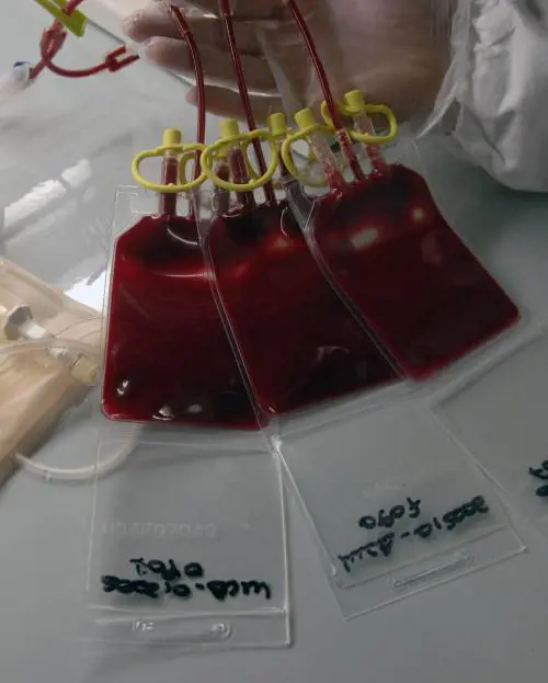 Prelievi di sangue inutili per gonfiare i rimborsi Perquisito il San Gerardo