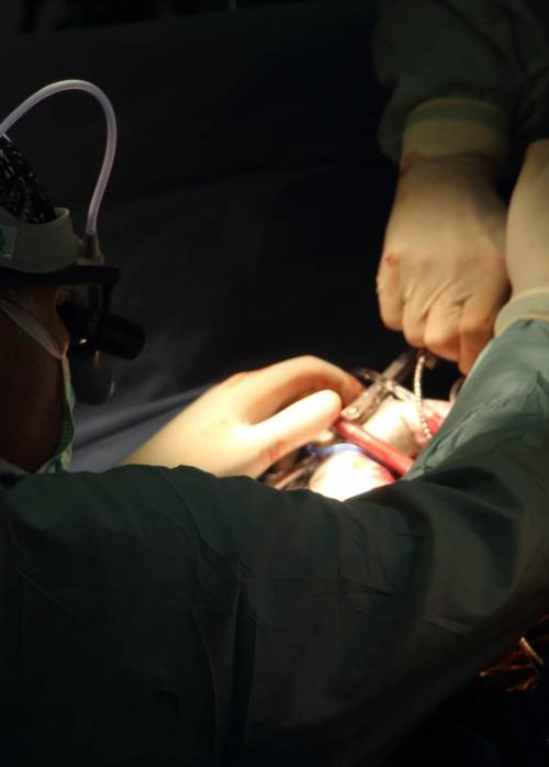Una nuova tecnica chirurgica per riparare la valvola aortica