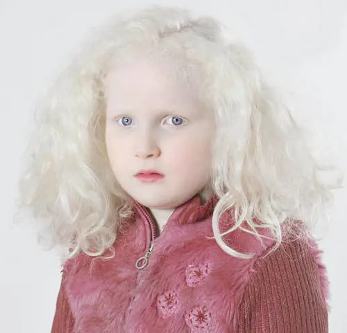 Scatti sulla quotidianità di persone «speciali»