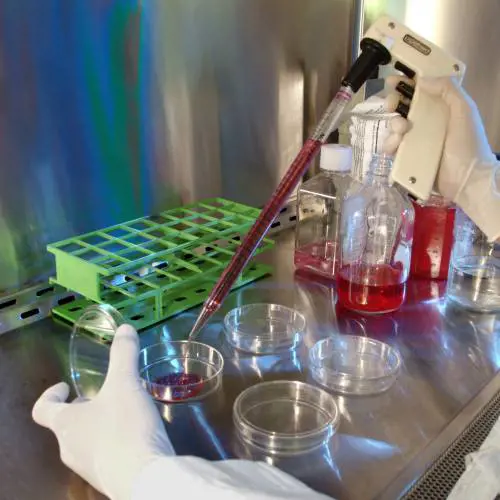 Guarisce dall'Hiv dopo trapianto di cellule staminali