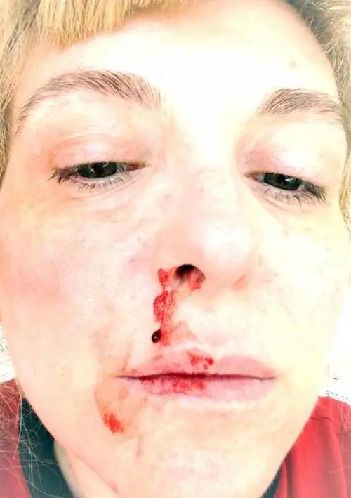 Anche la baby sitter accusa Di Cataldo