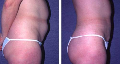 Quell'approccio più «soft» per ridefinire la silhouette