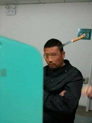 Cina, in coda al pronto soccorso con un coltello piantato in testa