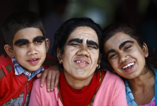 Nepal, soffrono di una malattia che li rende pelosissimi