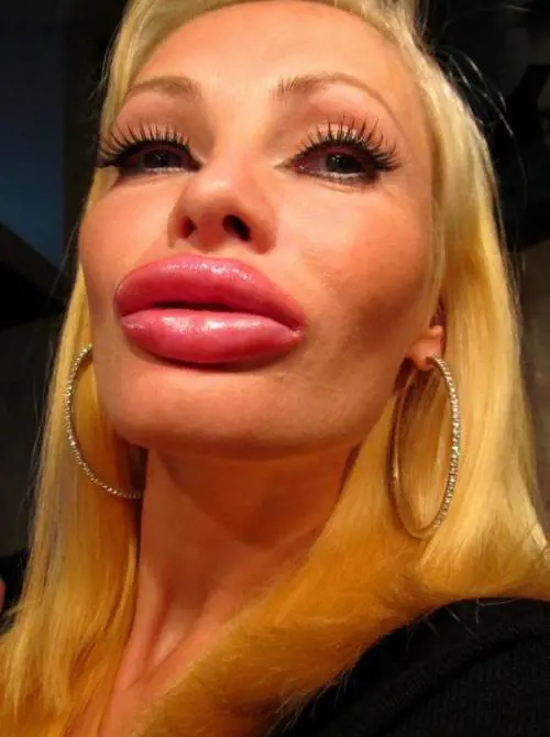 Spende 38mila euro in chirurgia estetica: "Ora mi adorano tutti"