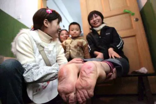 Wang Fang, la donna con i piedi al contrario