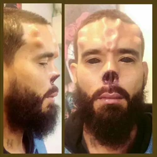 Fan di Red Skull si fa amputare il naso per assomigliare al personaggio Marvel