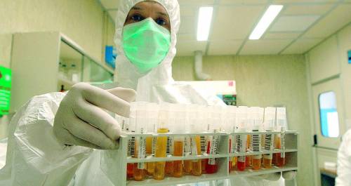 Aids, team italiano scopre inibitore naturale del virus