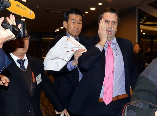 Sud Corea, ambasciatore americano aggredito da un uomo con un rasoio