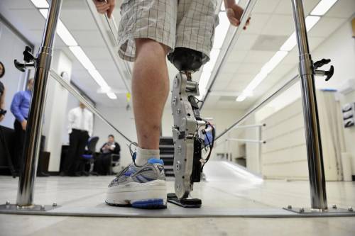 Chi ha subito amputazioni può tornare a camminare: pronte le prime gambe bioniche