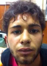 Ora i rom sparano anche alla polizia Ferito un agente