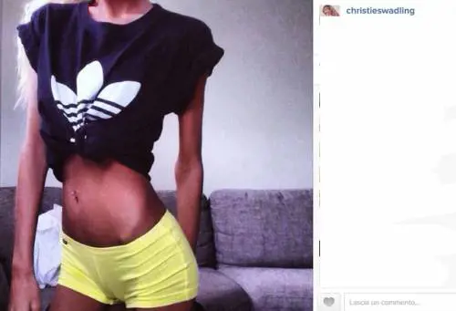 Smette di mangiare per diventare modella