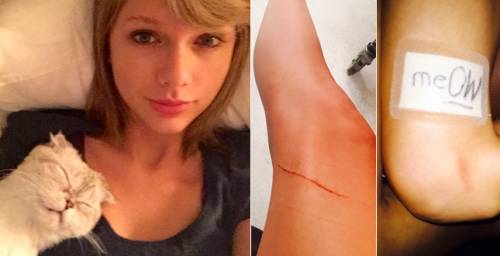 Taylor Swift, si assicura le gambe per 40 milioni di dollari e il gatto la graffia