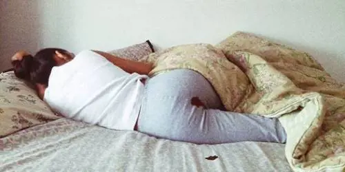 Questa fotografia è stata censurata ​dai social network