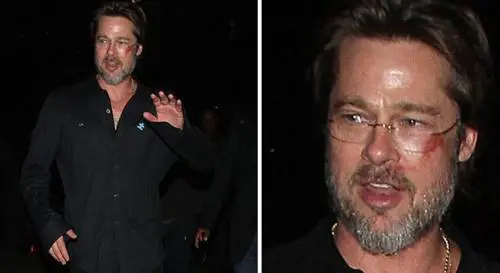 Brad Pitt all'evento di beneficenza con un occhio nero