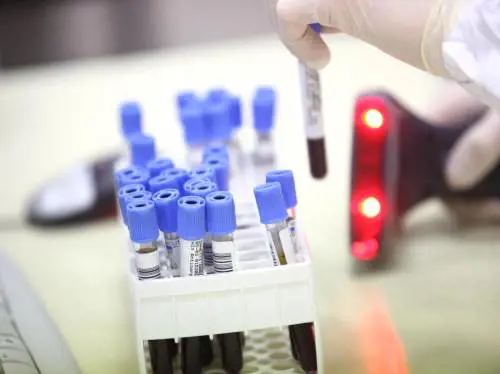 Sapremo se abbiamo il tumore al polmone con un test del sangue