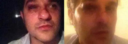 Aggredito l'ex Gf Mauro Marin: usciva da casa di una rumena