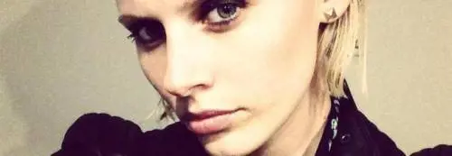 Le amputano una gamba per colpa di un assorbente: la modella fa causa all'azienda