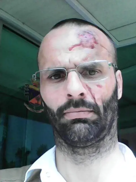 Pavia, gli occupano il box e poi lo pestano a sangue