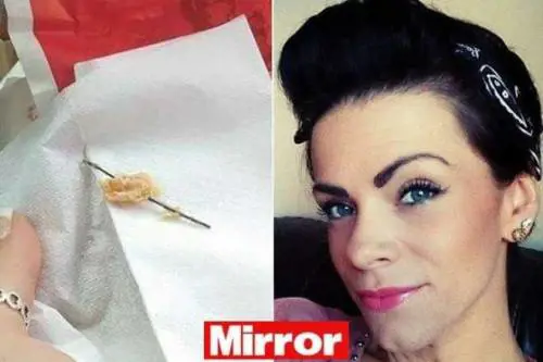Mangia al fast food e trova una placca di metallo nel panino