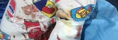 Cina, tigre strappa il braccio a un bambino di due anni allo zoo