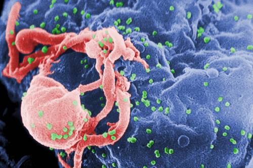 Dopo dodici anni senza terapie vede regredire il virus dell’Aids