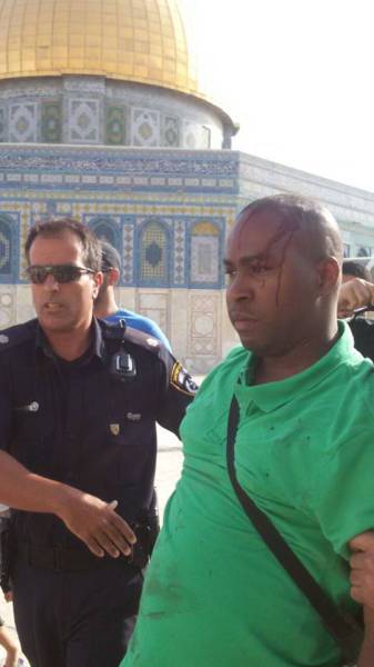 Turista francese aggredito da islamici sul Monte del Tempio