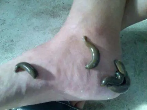 Salento: invasione in mare, vermi o sanguisughe