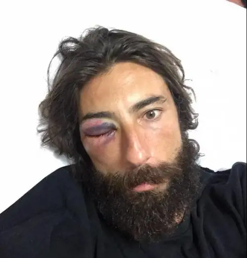 Brumotti nel selfie postato sul profilo Twitter